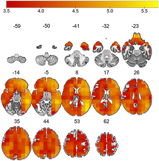 Haas_2022_accelerated_aging_cognitive_subtypes.jpeg