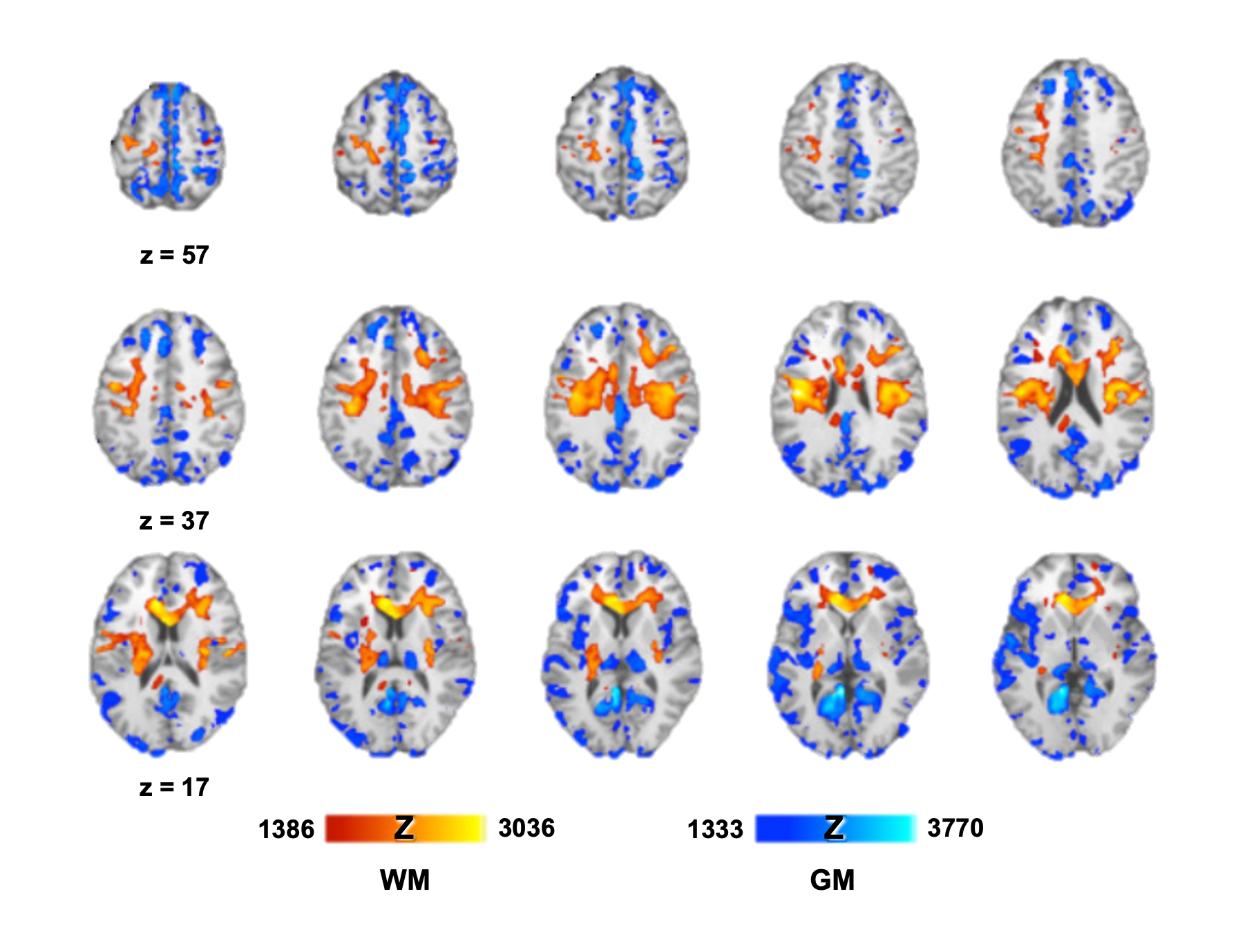 Kambeitz-Ilankovic_2019_neurocognitive_maturation.png