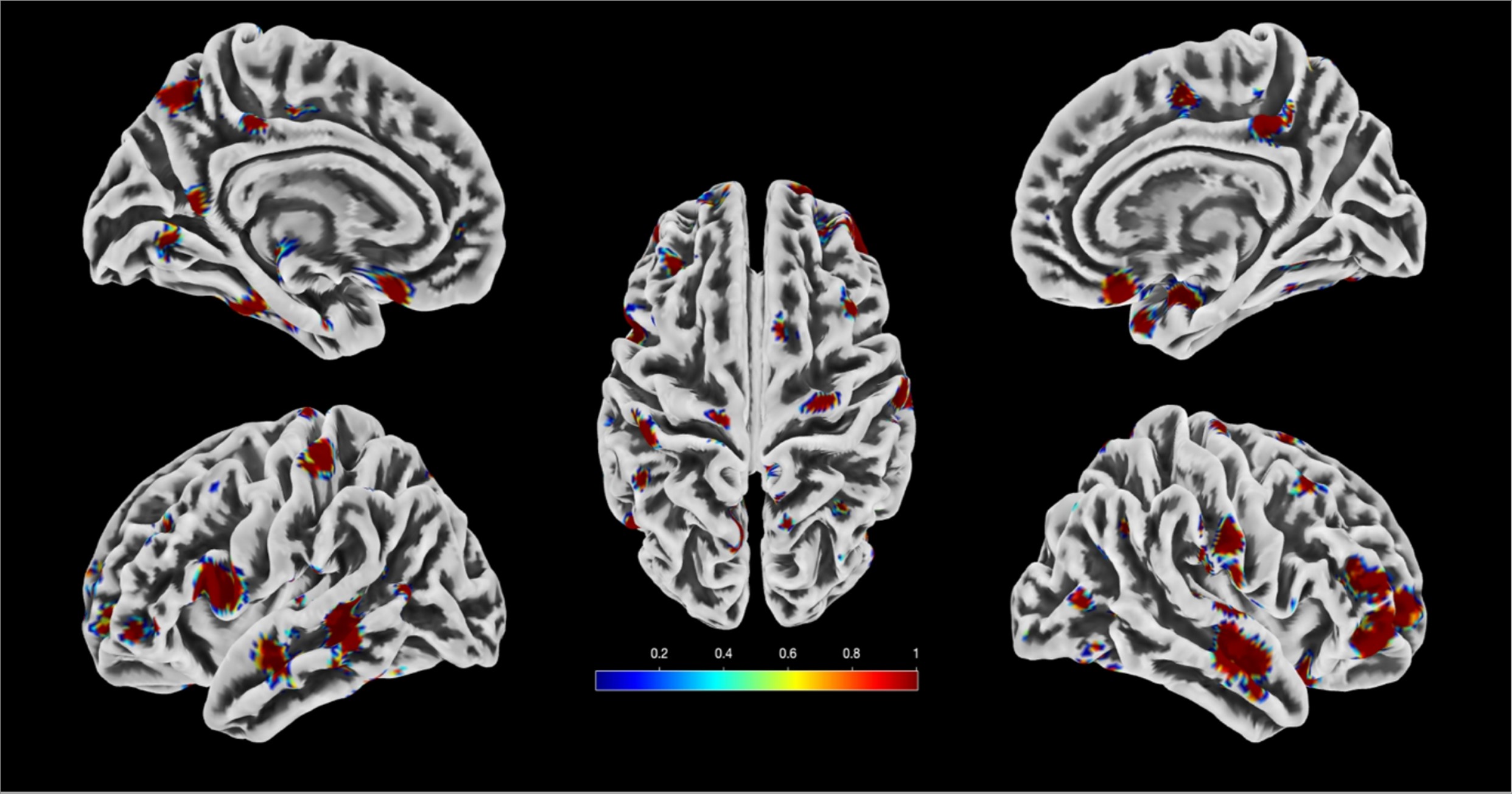 Korda_2025_brain_texture.png