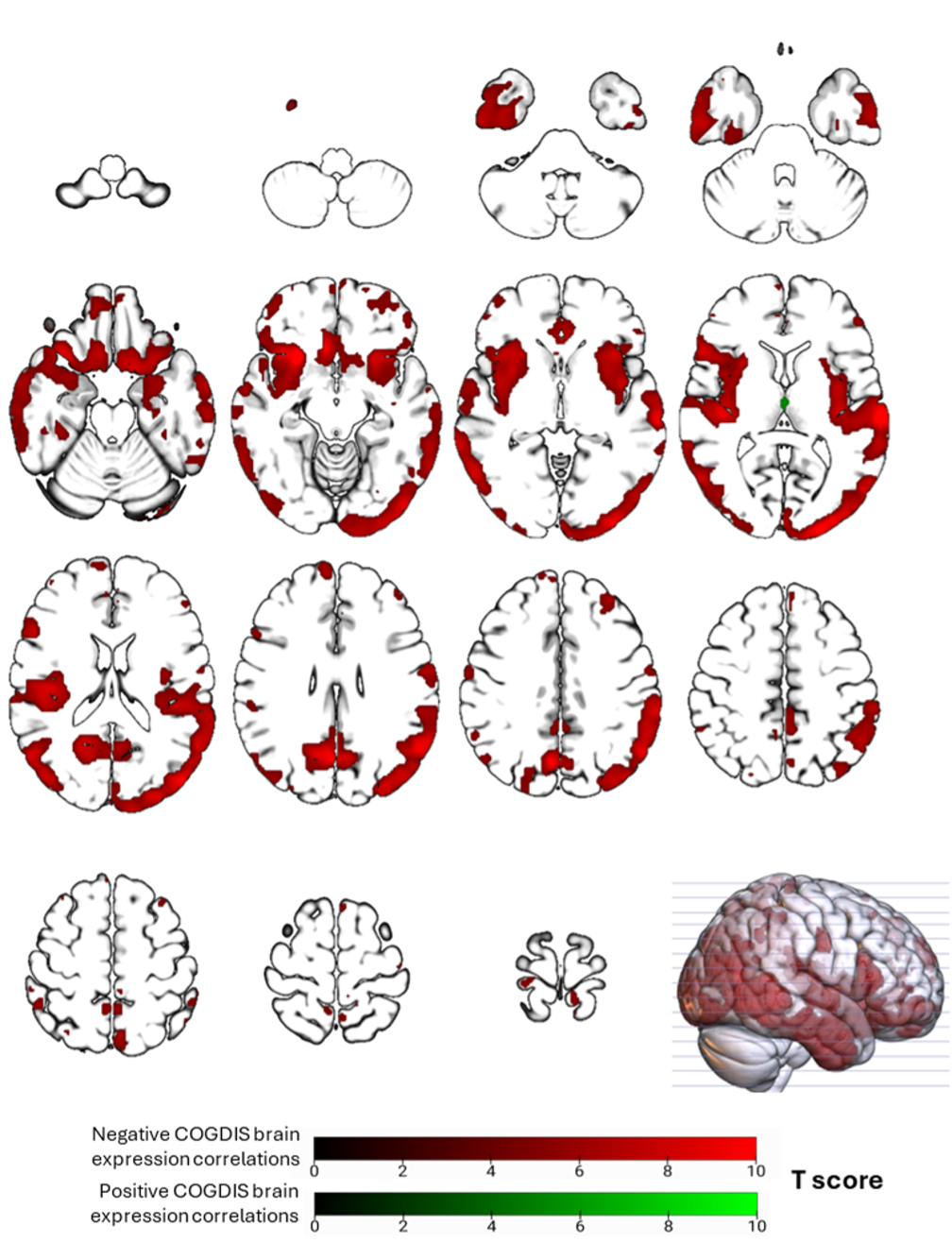 Koutsouleris_SCZ-Risk_brain_sig.png